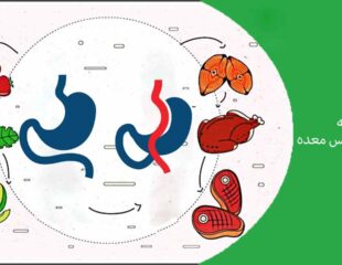 تغذیه بعد از بای پس معده