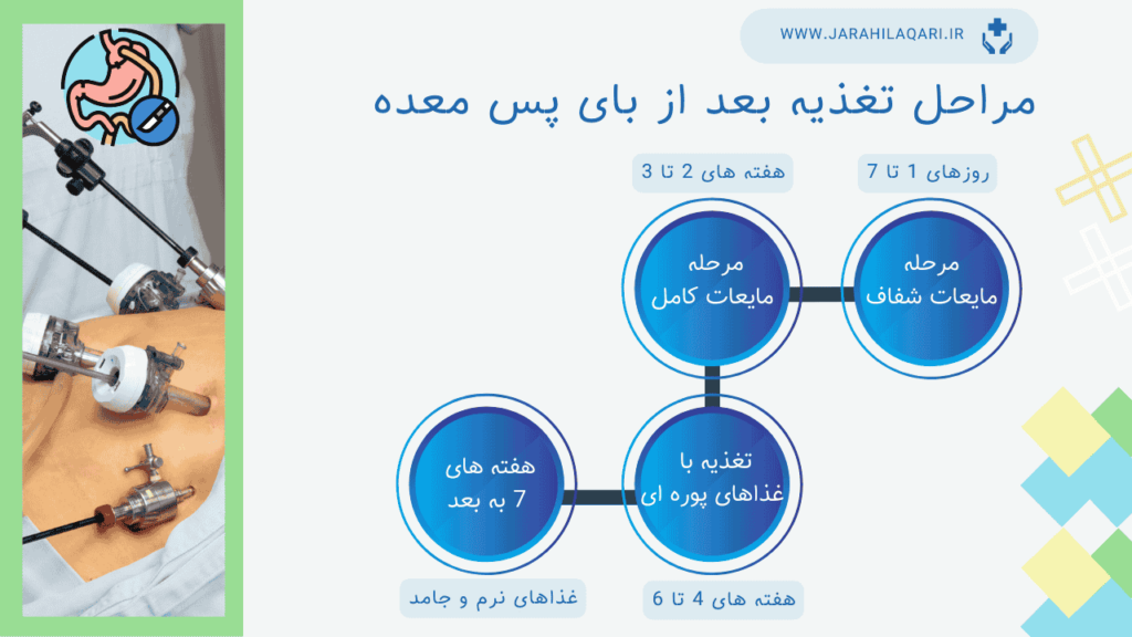 مراحل تغذیه بعد از بای پس معده